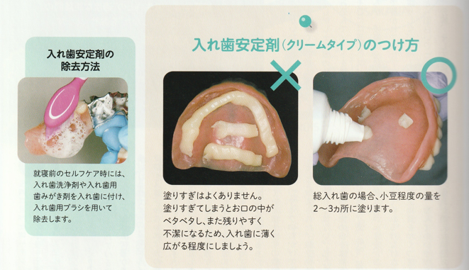 入れ歯安定剤について