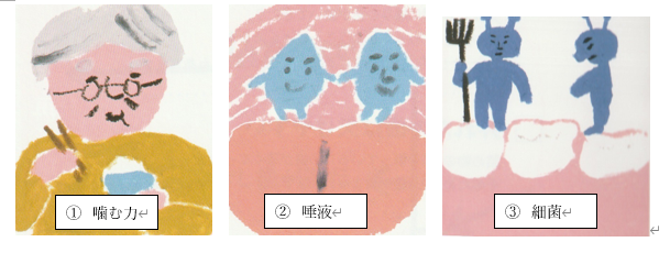 詰め物・被せものについて