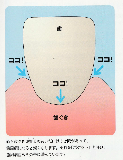 歯周病の原因菌てそもそも何？